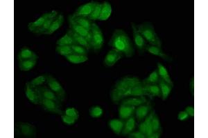 Immunofluorescence staining of HepG2 cells with ABIN7143530 at 1:200, counter-stained with DAPI. (NUDT5 antibody  (AA 34-166))