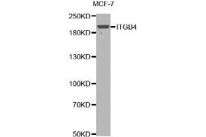 Western blot analysis of extracts of MCF7 cells lines, using ITGB4 antibody. (Integrin beta 4 antibody  (AA 28-310))