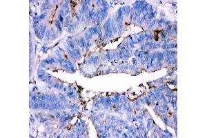 IHC analysis of ADA using anti-ADA antibody (ABIN4886424).