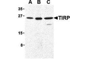 Western Blotting (WB) image for anti-Toll-Like Receptor Adaptor Molecule 2 (TICAM2) antibody (ABIN1030207) (TICAM2 antibody)