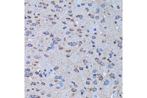 Immunohistochemistry of paraffin-embedded rat brain using IRAK4 antibody. (IRAK4 antibody  (AA 1-220))