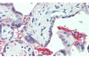 Detection of ECM1 in Human Placenta Tissue using Polyclonal Antibody to Extracellular Matrix Protein 1 (ECM1) (ECM1 antibody  (AA 20-434))