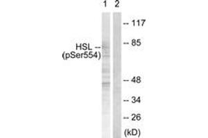 Western blot analysis of extracts from HeLa cells treated with Adriamycin 0. (LIPE antibody  (pSer855))