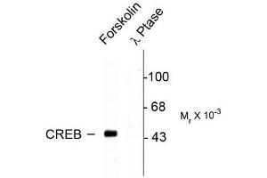 Image no. 1 for anti-cAMP Responsive Element Binding Protein 1 (CREB1) (pSer133) antibody (ABIN372604) (CREB1 antibody  (pSer133))