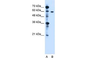 WB Suggested Anti-ZDHHC13 Antibody Titration:  1. (ZDHHC13 antibody  (N-Term))