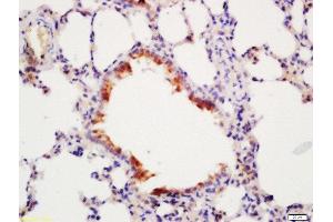 Formalin-fixed and paraffin embedded mouse lung labeled with Rabbit Anti-ATG4D Polyclonal Antibody, Unconjugated  at 1:200 followed by conjugation to the secondary antibody and DAB staining (ATG4D antibody  (AA 381-474))