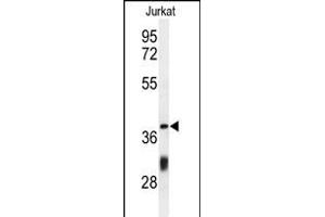 Western blot analysis of C Antibody (Center) (ABIN650934 and ABIN2840000) in Jurkat cell line lysates (35 μg/lane). (CCDC130 antibody  (AA 173-200))