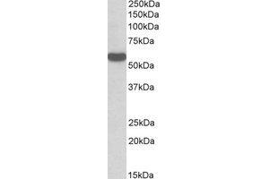 Western Blotting (WB) image for anti-Chromosome 22 Open Reading Frame 28 (C22orf28) (Internal Region) antibody (ABIN2464466)