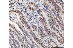 IHC analysis of C1orf77/FOP/CHTOP using anti-C1orf77/FOP/CHTOP antibody (ABIN7603201).