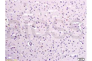 Formalin-fixed and paraffin embedded rat brain labeled with Anti-Caspase-9 Polyclonal Antibody, Unconjugated (ABIN724175) 1:300 followed by conjugation to the secondary antibody and DAB staining (Caspase 9 antibody  (AA 271-314))
