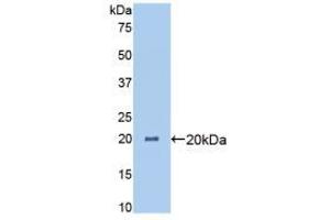 Western blot analysis of recombinant Pig ANGPTL4. (ANGPTL4 antibody  (AA 227-389))