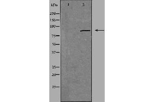 Western blot analysis of extracts from HUVEC cells, using CGK 2 antibody. (PRKG2 antibody  (N-Term))