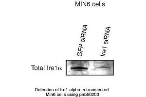 Image no. 1 for anti-Endoplasmic Reticulum To Nucleus Signaling 1 (ERN1) (AA 700-800) antibody (ABIN363509) (ERN1 antibody  (AA 700-800))