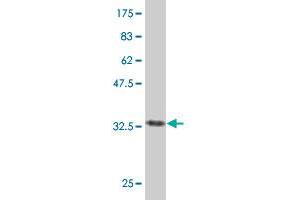 Western Blot detection against Immunogen (38. (PTGIS antibody  (AA 391-500))