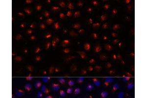 Immunofluorescence analysis of HeLa cells using ACTN3 Polyclonal Antibody at dilution of 1:100 (40x lens). (ACTN3 antibody)
