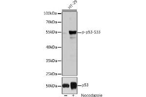 Western Blotting (WB) image for anti-Tumor Protein P53 (TP53) (pSer33) antibody (ABIN6136276)