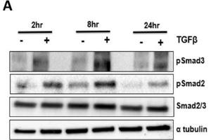 Western Blotting (WB) image for anti-alpha Tubulin (TUBA1) (C-Term) antibody (ABIN964563)