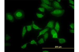 Immunofluorescence of monoclonal antibody to PDIA5 on HeLa cell. (PDIA5 antibody  (AA 31-130))