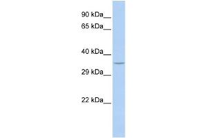 WB Suggested Anti-SPDYA Antibody Titration: 0.