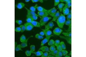 IF analysis of YTHDF2 using anti-YTHDF2 antibody (ABIN7603191). (YTHDF2 antibody  (N-Term))