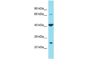 Host: Rabbit Target Name: C6orf120 Sample Type: Hela Whole cell lysates Antibody Dilution: 1. (C6ORF120 antibody  (C-Term))