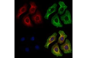ABIN6264030 and ABIN6277904 staining HepG2 cells by IF/ICC. (Pannexin 3 antibody  (Internal Region))