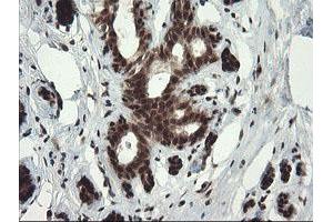 Image no. 1 for anti-Replication Factor C (Activator 1) 2, 40kDa (RFC2) (AA 1-234) antibody (ABIN1490617) (RFC2 antibody  (AA 1-234))