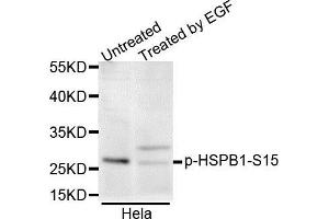 Western blot analysis of extracts of various cell lines, using Phospho-HSPB1-S15 antibody. (HSP27 antibody  (pSer15))
