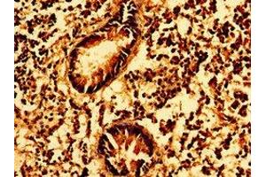 Immunohistochemistry of paraffin-embedded human appendix tissue using ABIN7154565 at dilution of 1:100 (GSX1/GSH1 antibody  (AA 67-147))