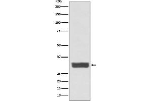 Western blot analysis of Galectin 3 expression in MCF-7 cell lysate. (Recombinant Galectin 3 antibody)
