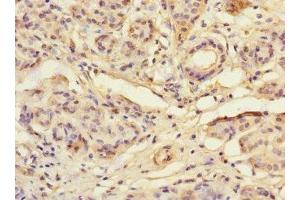Immunohistochemistry of paraffin-embedded human salivary gland tissue using ABIN7171878 at dilution of 1:100