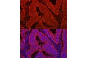 Immunofluorescence analysis of human colon carcinoma using LG Rabbit pAb (ABIN7268200) at dilution of 1:100 (40x lens). (Galectin 2 antibody  (AA 1-132))