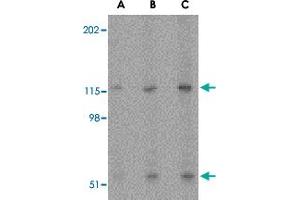 Western blot analysis of PRSS12 in SK-N-SH cell lysate with PRSS12 polyclonal antibody  at (A) 0. (Neurotrypsin antibody  (N-Term))