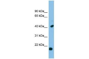 HSPB2 antibody used at 1 ug/ml to detect target protein. (HSPB2 antibody  (Middle Region))