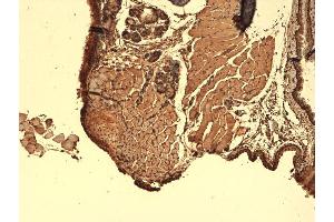 Immunohistochemistry (IHC) image for anti-Solute Carrier Family 5 (Sodium/iodide Cotransporter), Member 5 (SLC5A5) (AA 468-643) antibody (PerCP) (ABIN2484444)