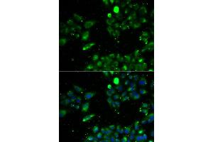 Immunofluorescence analysis of U2OS cell using UQCRFS1 antibody.