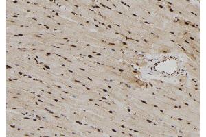 ABIN6279782 at 1/100 staining Rat heart tissue by IHC-P. (RPS6KL1 antibody  (Internal Region))