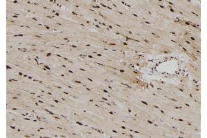 ABIN6279782 at 1/100 staining Rat heart tissue by IHC-P.