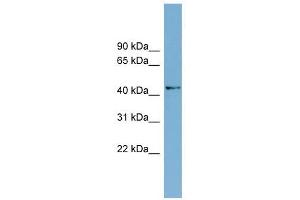 AMDHD1 antibody used at 1 ug/ml to detect target protein. (AMDHD1 antibody  (N-Term))