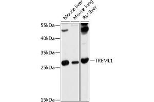 Western blot analysis of extracts of various cell lines, using TREML1 antibody (ABIN6129498, ABIN6149484, ABIN6149485 and ABIN6214659) at 1:1000 dilution.