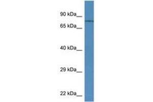 Image no. 1 for anti-Transient Receptor Potential Cation Channel, Subfamily V, Member 6 (TRPV6) (AA 280-329) antibody (ABIN6746125) (TRPV6 antibody  (AA 280-329))