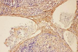 Anti-C5/C5a antibody, IHC(P) IHC(P): Rat Spleen Tissue (C5 antibody  (N-Term))