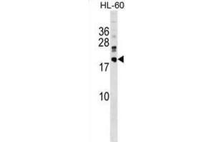 Western Blotting (WB) image for anti-DnaJ (Hsp40) Homolog, Subfamily C, Member 30 (DNAJC30) antibody (ABIN5019514) (DNAJC30 antibody)