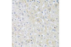 Immunohistochemistry of paraffin-embedded rat liver using SLC4 antibody (ABIN6132890, ABIN6148015, ABIN6148016 and ABIN6214688) at dilution of 1:100 (40x lens). (NBC4 antibody  (AA 1042-1121))