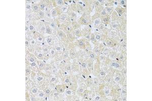 Immunohistochemistry of paraffin-embedded rat liver using SLC4 antibody (ABIN6132890, ABIN6148015, ABIN6148016 and ABIN6214688) at dilution of 1:100 (40x lens).