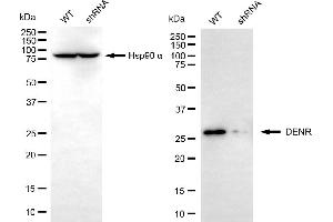 Western blotting analysis using DENR antibody (ABIN7798306).