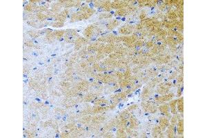 Immunohistochemistry of paraffin-embedded Mouse heart using BMP3 Polyclonal Antibody at dilution of 1:100 (40x lens). (BMP3 antibody)