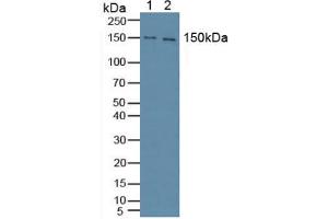 Western blot analysis of (1) Mouse Brain Tissue and (2) Human HeLa cells. (Phospholipase C gamma 1 antibody  (AA 1091-1290))