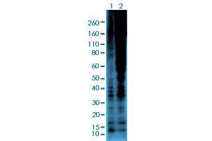 Western blot analysis of Lane 1: serum-starved A431 cells, Lane 2: serum-starved A431 cells treated with Calyculin A/Okadaic Acid using Phosphothreonine monoclonal antibody, clone RM102  at 1:2000 dilution. (Phosphothreonine antibody)