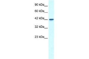 WB Suggested Anti-GFI1B Antibody Titration: 0. (GFI1B antibody  (N-Term))